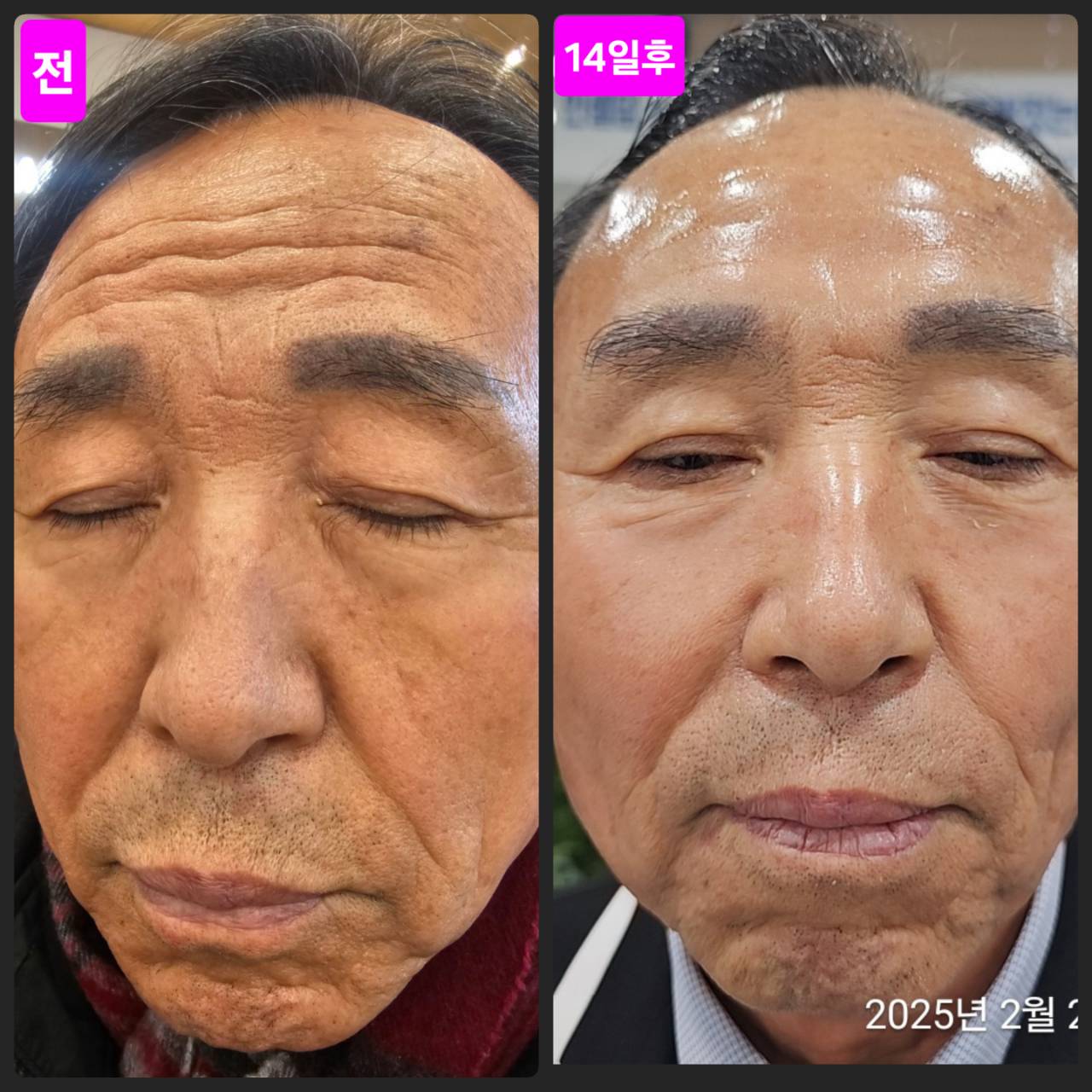 HOW TO 7DAYS Change - インセルダム(INCELLDERM)最初の7日間