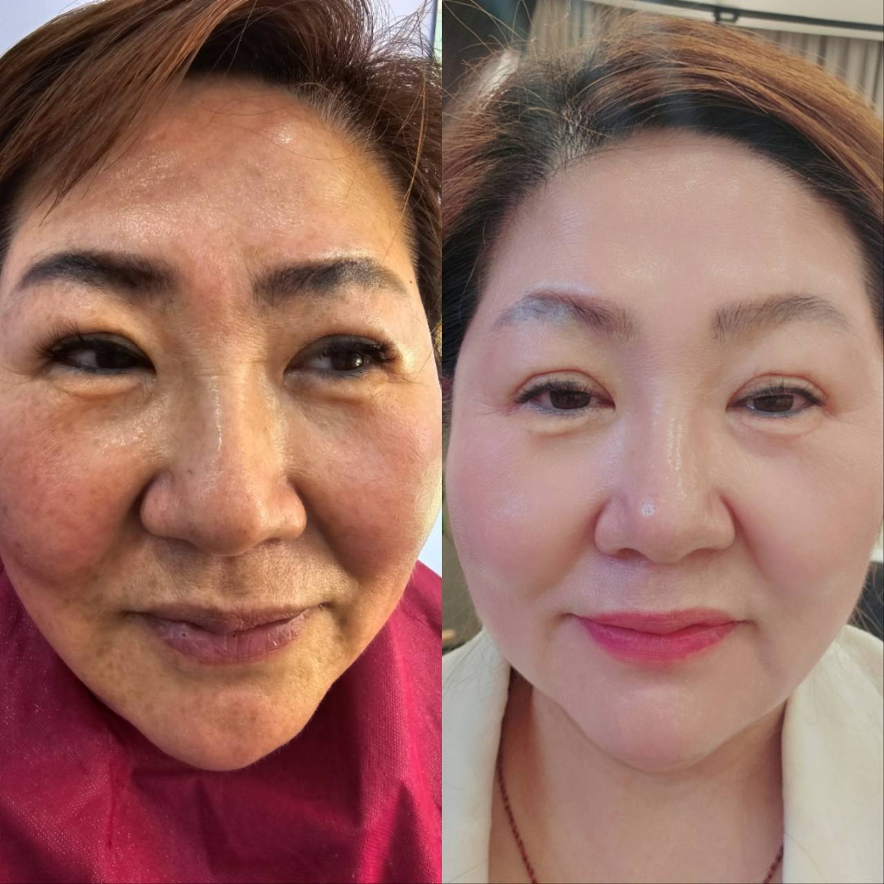 HOW TO 7DAYS Change - インセルダム(INCELLDERM)最初の7日間