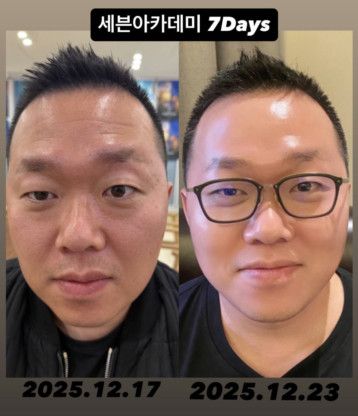 HOW TO 7DAYS Change - インセルダム(INCELLDERM)最初の7日間