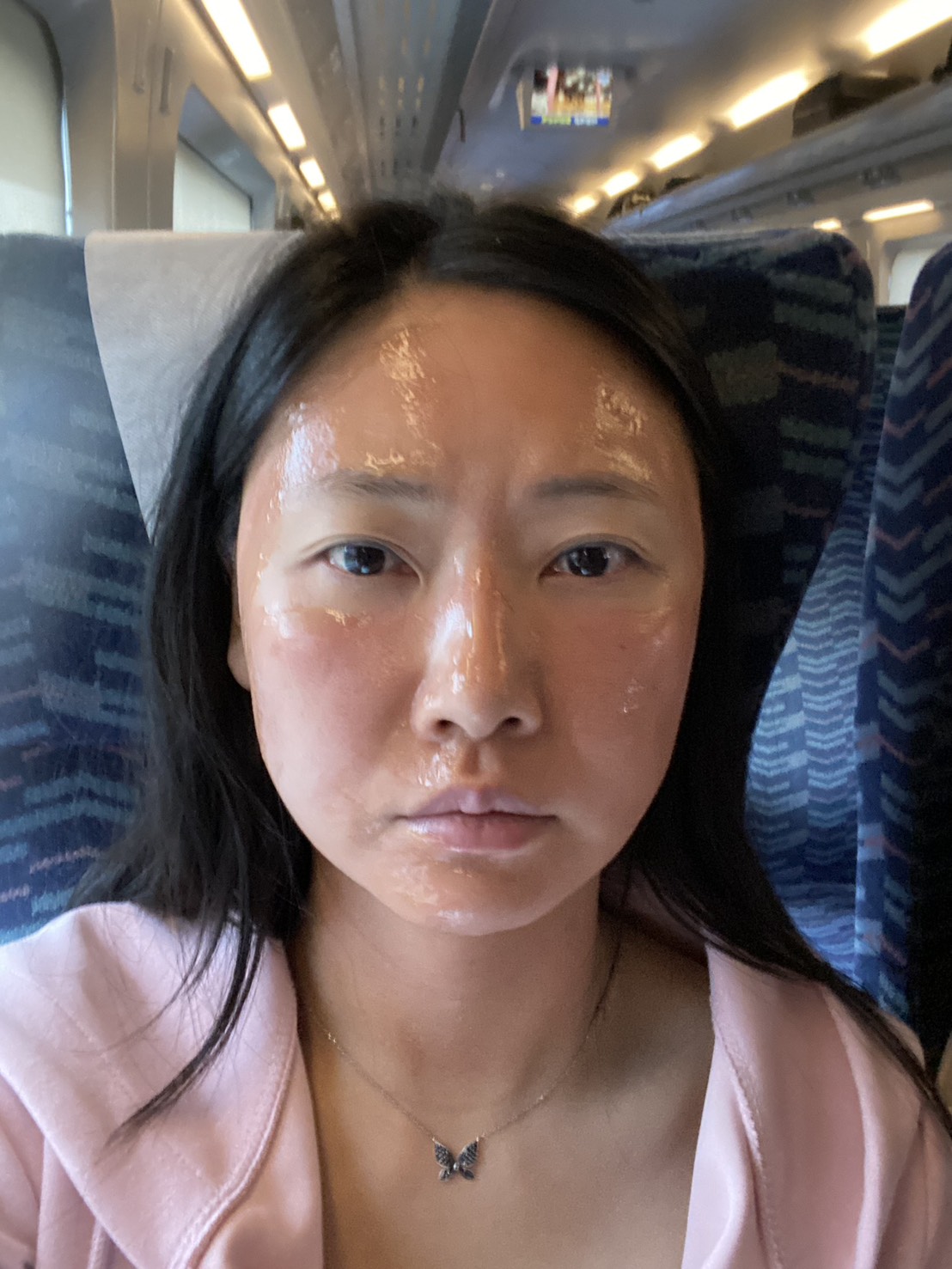 インセルダム使用中の好転反応（みな先生）